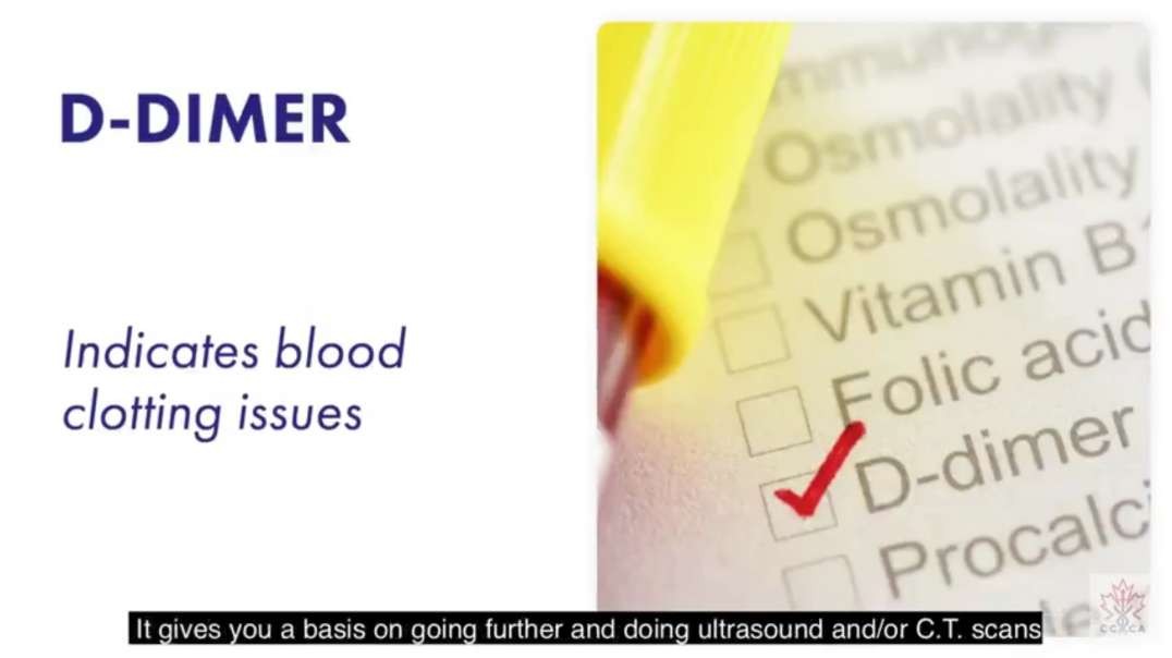 NR.5 - the D DIMER TEST who few dare to talk - link with BLOOD CLOTTING - link with JABS - VACCINES !