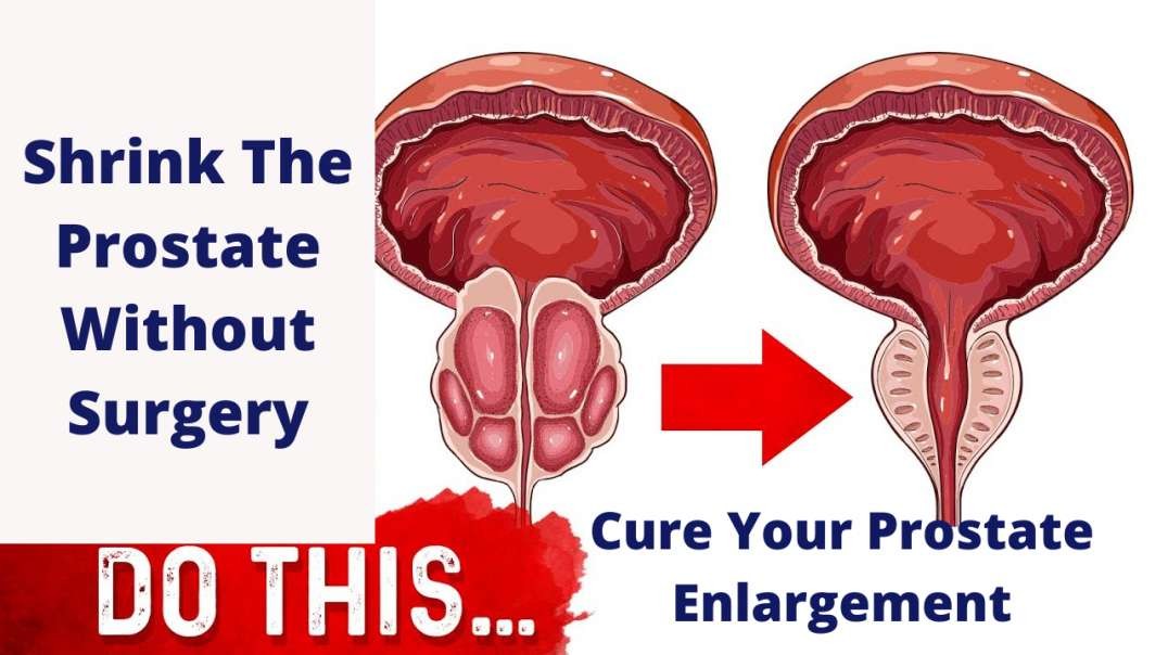 How To Overcame Prostate Enlargement Without Surgery