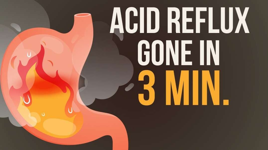 How to treat heartburn (acid reflux) and indigestion