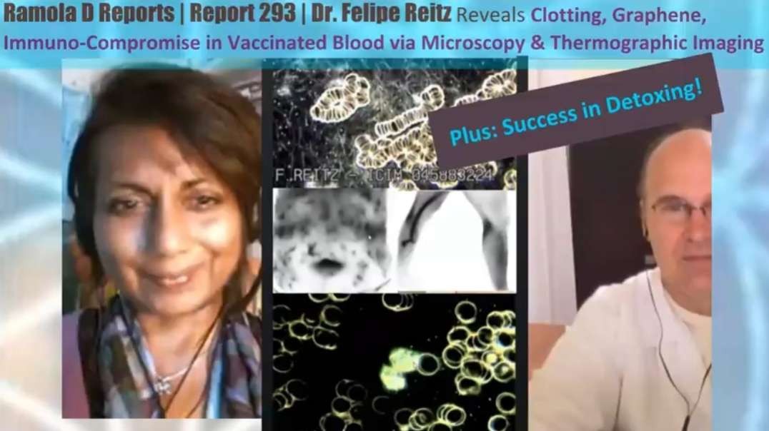 Dr. Felipe Reitz - Clotting, Graphene, Immuno-Compromise in Vaccinated Blood - Ramola D Reports