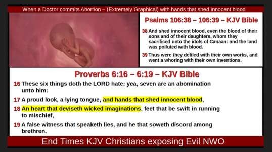 When a Doctor commits Abortion – (Extremely Graphical) with hands that shed innocent blood