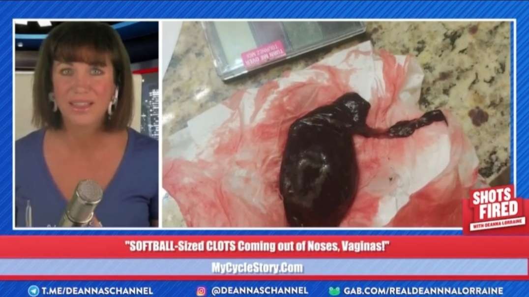 Dr. James Thorp and Tiffany Parotto - “SOFTBALL-Sized CLOTS Coming Out of Noses, Vaginas!” - Shots Fired with DeAnna Lorraine (11/10/22)