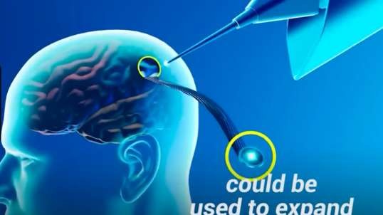 2023 Neuralink Updates (BCI-hivemind was established in 1970s)