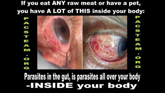 Parasites; NO one wants you to know, you don't want to know -BUT YOU HAVE TO