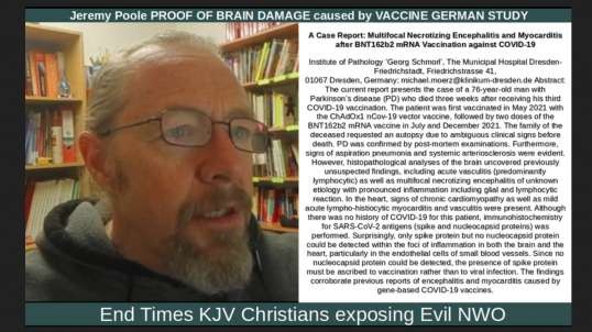 Jeremy Poole: PROOF OF BRAIN DAMAGE caused by 'VACCINE'!!!!! GERMAN STUDY!!