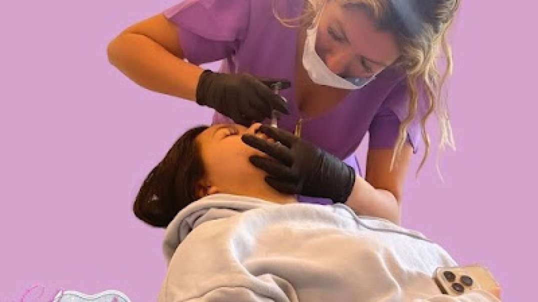 Best Lip Fillers treatment in New Addington