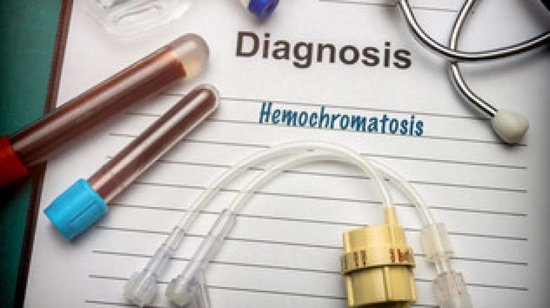 Hemochromatosis Blood Iron Levels