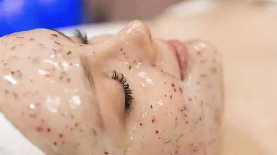Are you looking for Dermal Needling in Chatswood?
