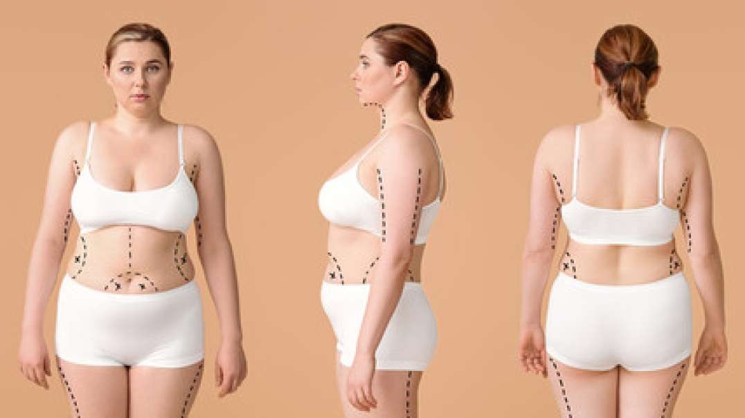 Resurge Weight Loss Supplement