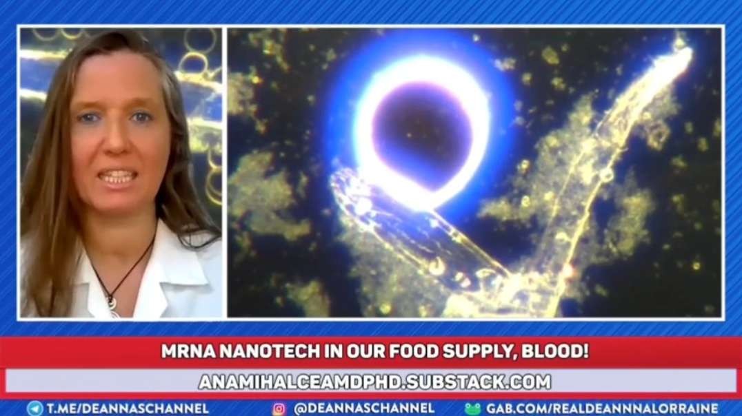 Dr. Ana Maria Mihalcea - Self-Assembling NANO “Worms” in FOOD, Blood & the UN-Vaxxed! Is it Being Sprayed in the Air? -Shots Fired with DeAnna Lorraine