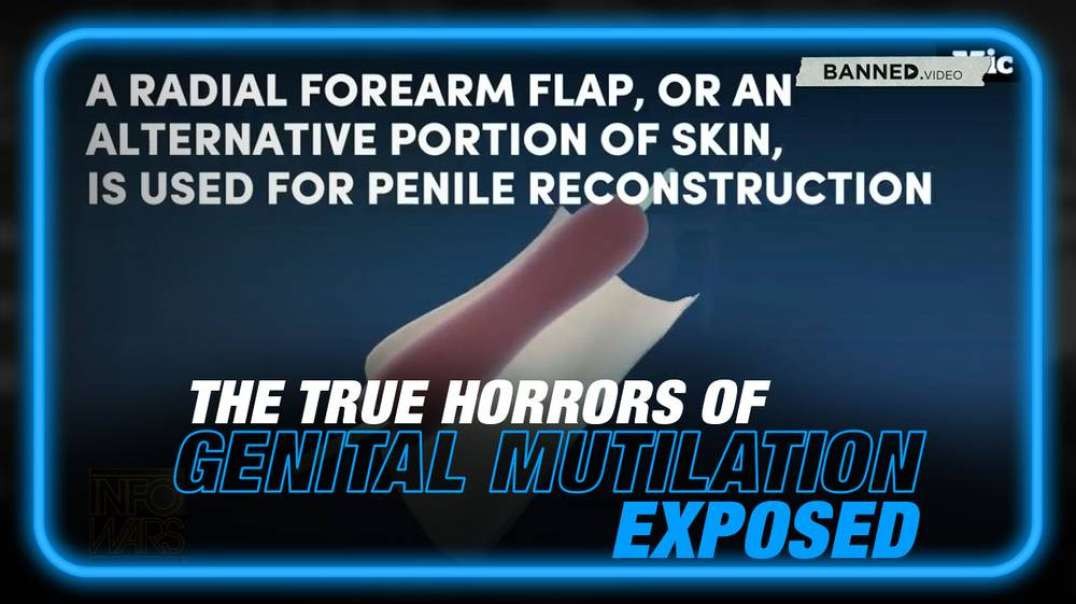 VIDEO- Learn the True Horrors of Genital Mutilation Before It's Too Late