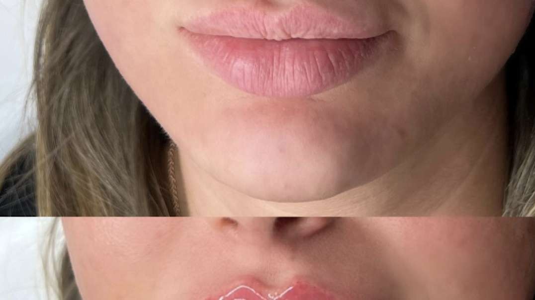 Best Lip Blush treatment in Datchet