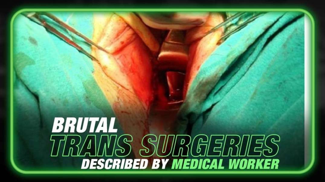 Viewer Discretion Advised- Medical Worker Describes Brutal Trans Surgeries