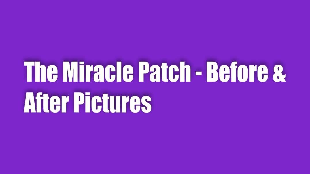 The Miracle Patch – Before & After Pictures & Stories!
