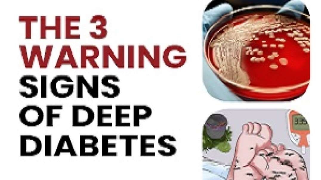 The 3 Warning Signs Of Deep Diabetes