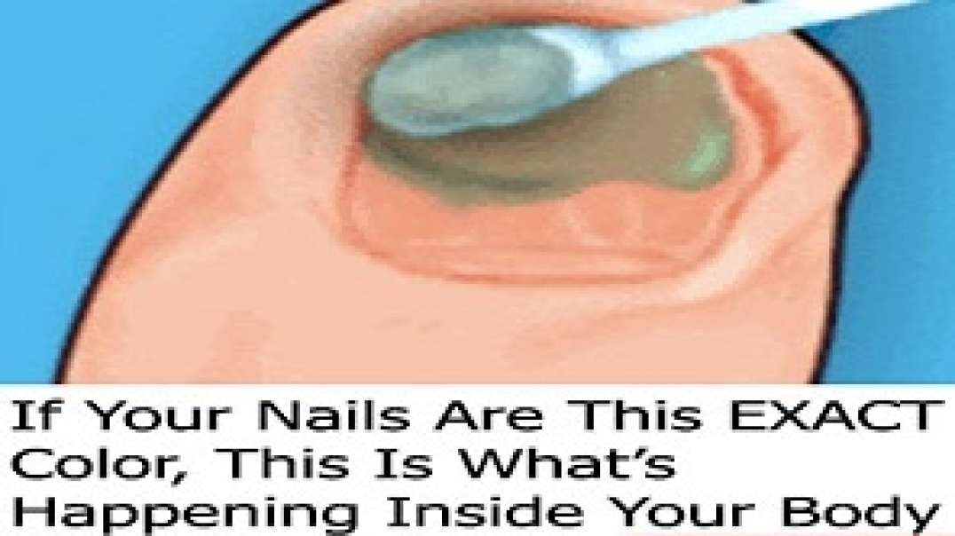 If Your Nails Are This EXACT Color, This Is What's Happening Inside Your Body (Do This Now).mp4