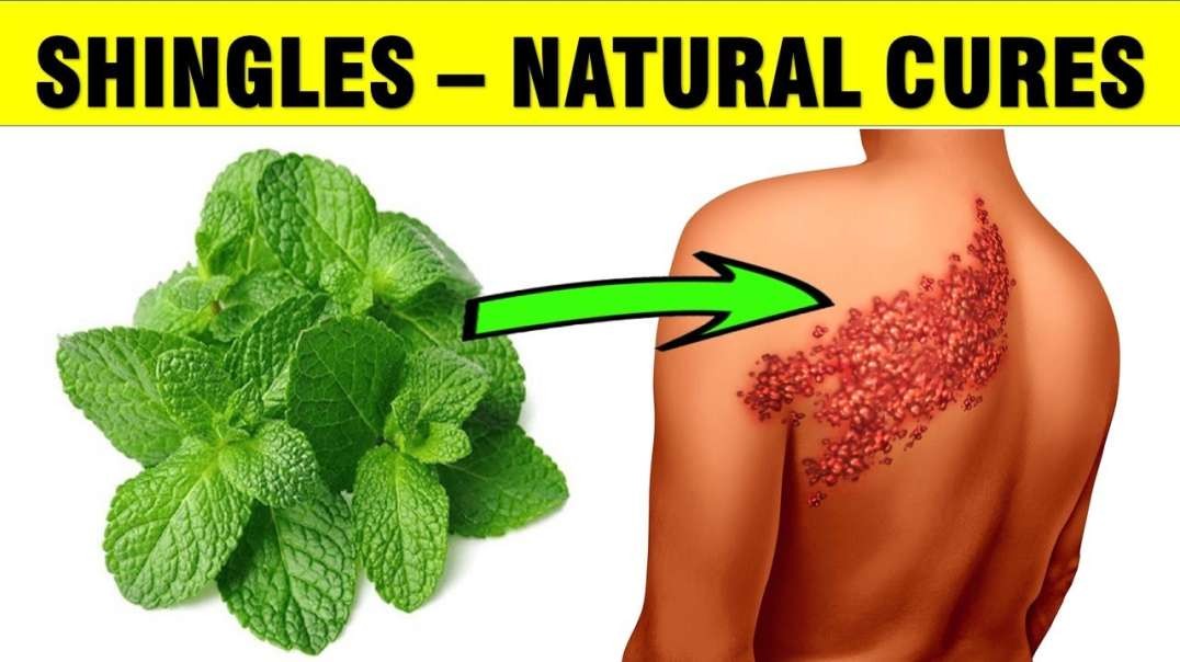 How To Eliminate Shingles and painful rashes with blisters