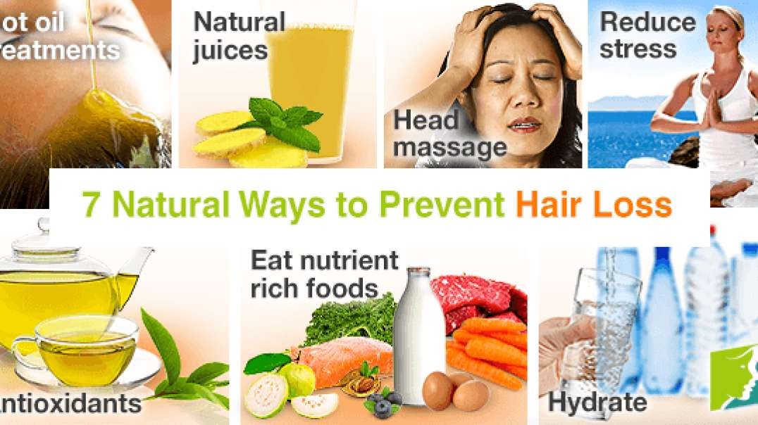 HERE'S MY UPDATE ON WHAT TO DO IF YOUR GOING BALD AS A WOMAN.