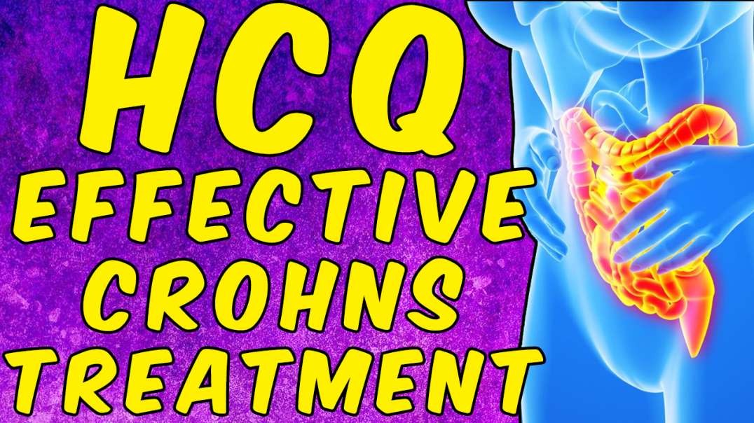 How Effective Is Hydroxychloroquine (HCQ) For Crohn’s Disease?