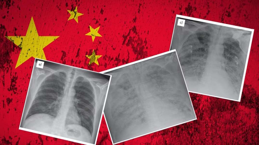 Dr. Lee Merritt: Exposing The Latest "Chinese White Lung" Narrative - Same Playbook As COVID