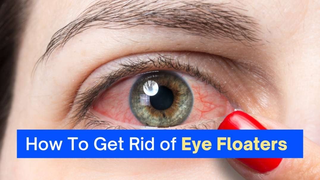 How To Get Rid of Eye Floaters, Eye Flashes and Eye Spots
