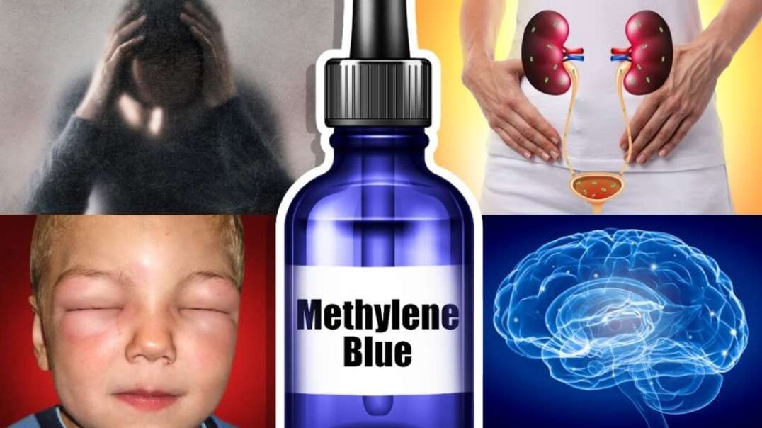 Fascinating Health Benefits of Methylene Blue - Dr. Eric Berg