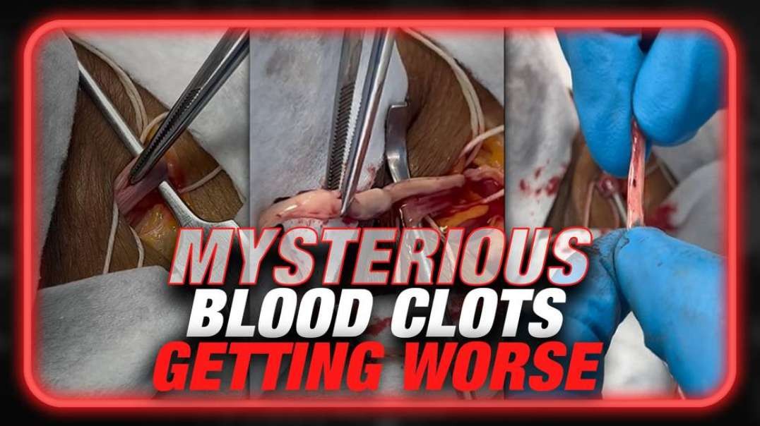 BREAKING- Funeral Home Director Warns Mysterious Blood Clots Getting Worse