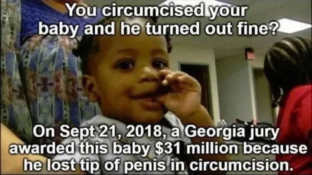 KC's Circumcision Day