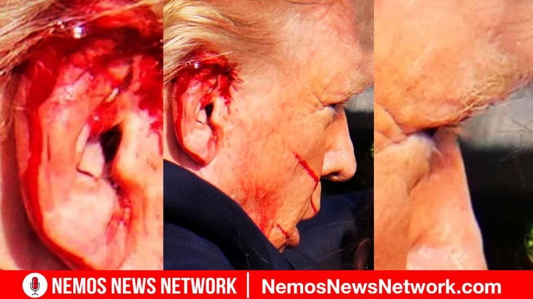 PROOF TRUMP FAKED THE SHOOTING!?! BY DUSTIN NEMOS
