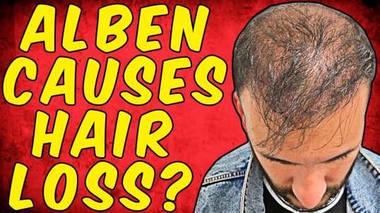 Can Albendazole Cause Hair Loss? - (Science Based)