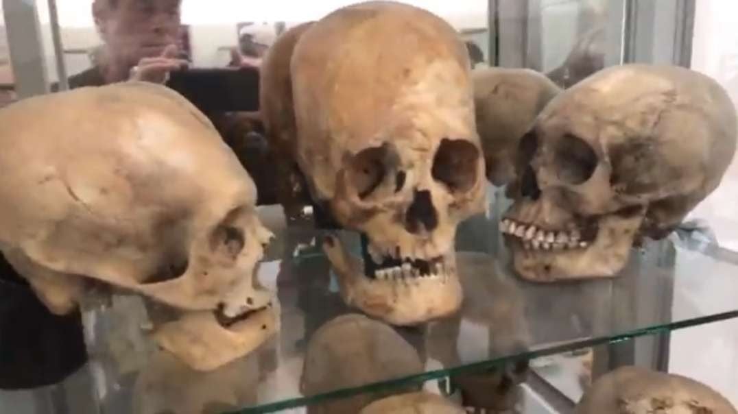 Elongated Skulls(Homo capensis) Of The Paracas Museum, Peru + Starchild(four separate skulls known)