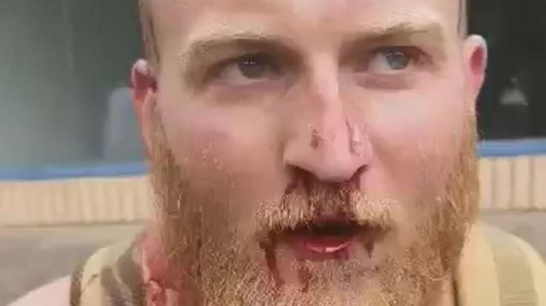 Red Bearded White Man Survives Muslim Defence League Child Rapist Stabbing With Beating!