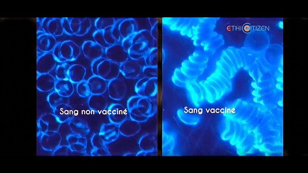 💡_💉 Quels sont les effets des vaccins anti-covid sur notre sang ?