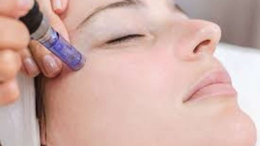 Are you looking for Microneedling in Finglas West?