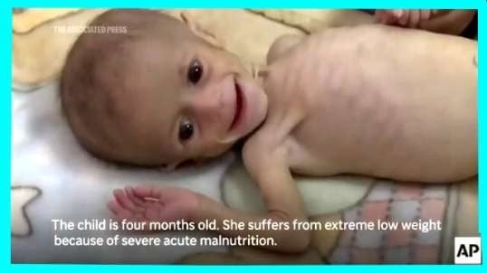 US complicity in the Israeli famine in Gaza is a policy, not an accident