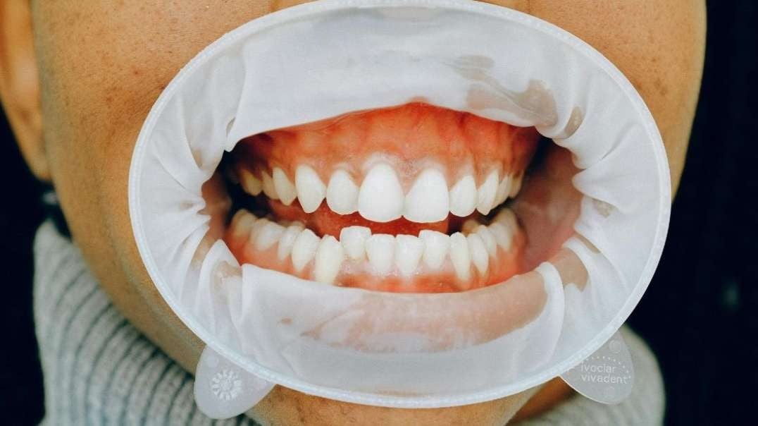 Health reform: how to heal your teeth and gums naturally