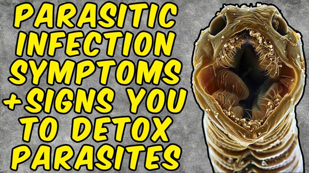 Parasitic Infection Symptoms That Are a Sign You Need to Detox Parasites!