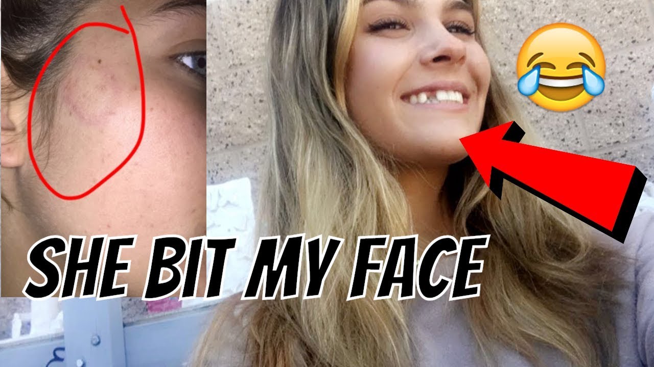 storytime how I lost my tooth