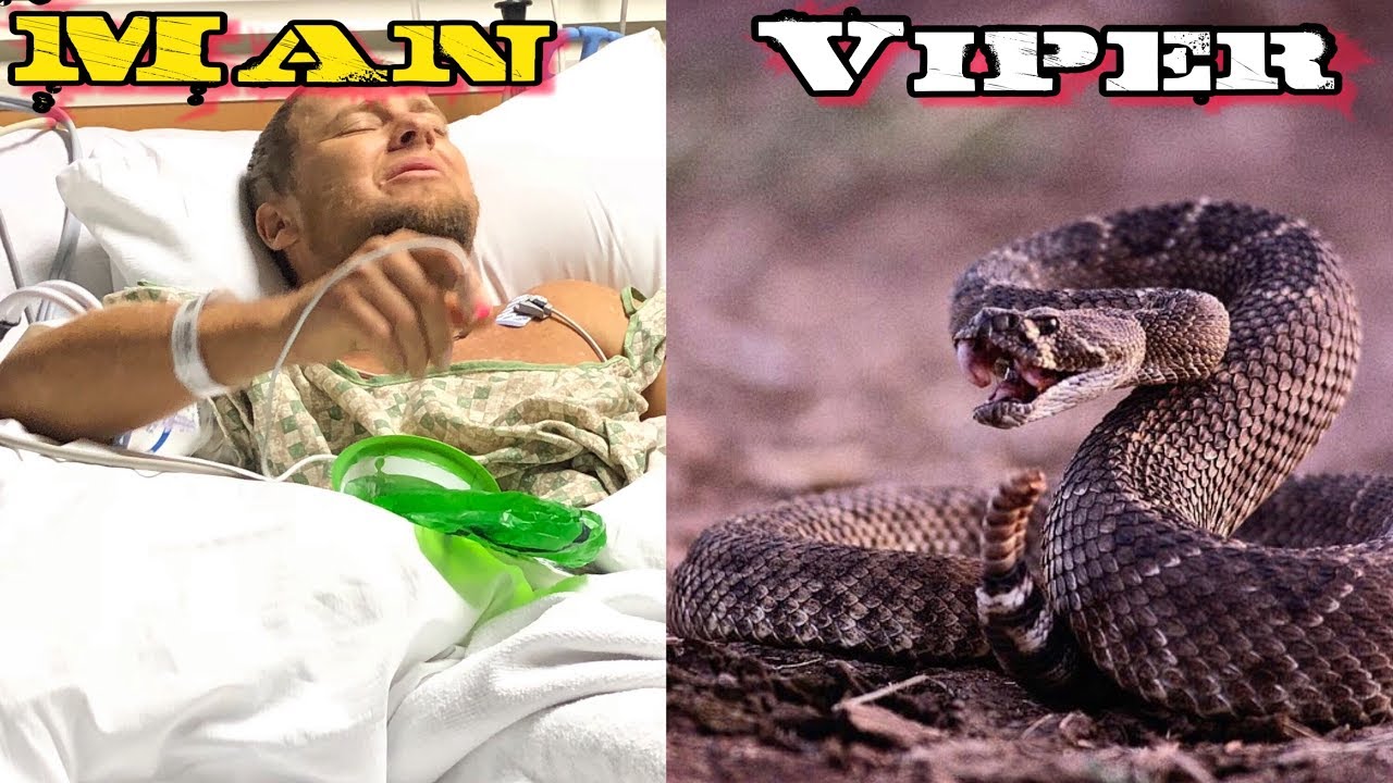 Bob Hansler in ICU • Man Vs Viper • Venomous Snake